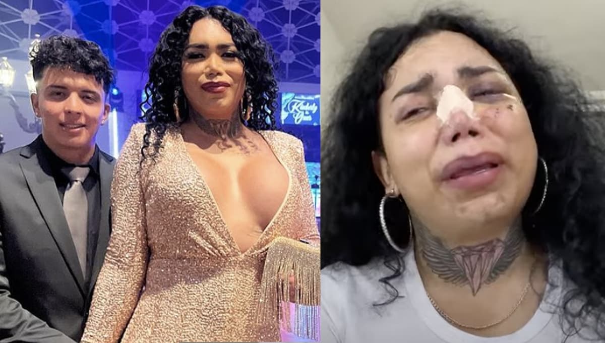 Tras ser golpeada, Paola Suárez reaparece con su agresor