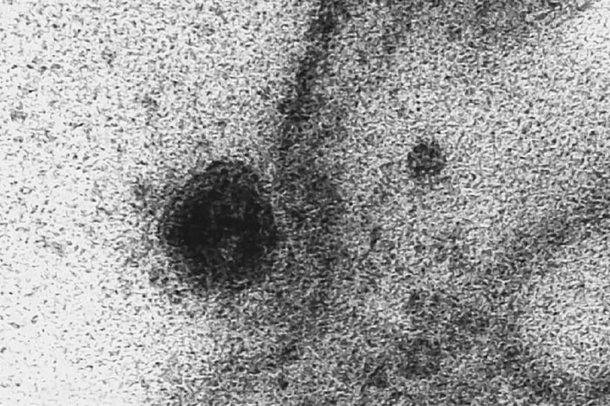 Así se ve el momento exacto en el que el coronavirus infecta una célula