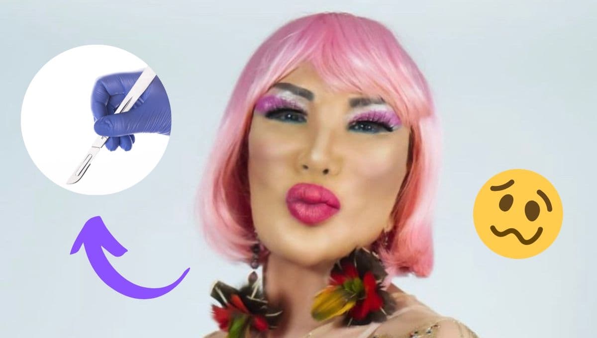 ¿Qué le pasó en el rostro a Lyn May?