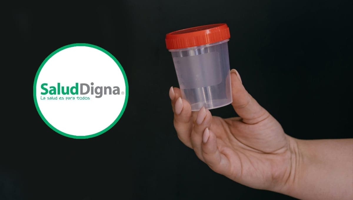 Salud Digna: ¿qué incluye el examen general de orina y cuánto cuesta?
